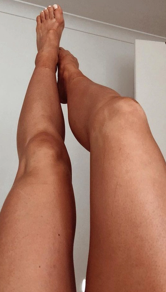 Pele depois do Bronzi com bronzeado dourado